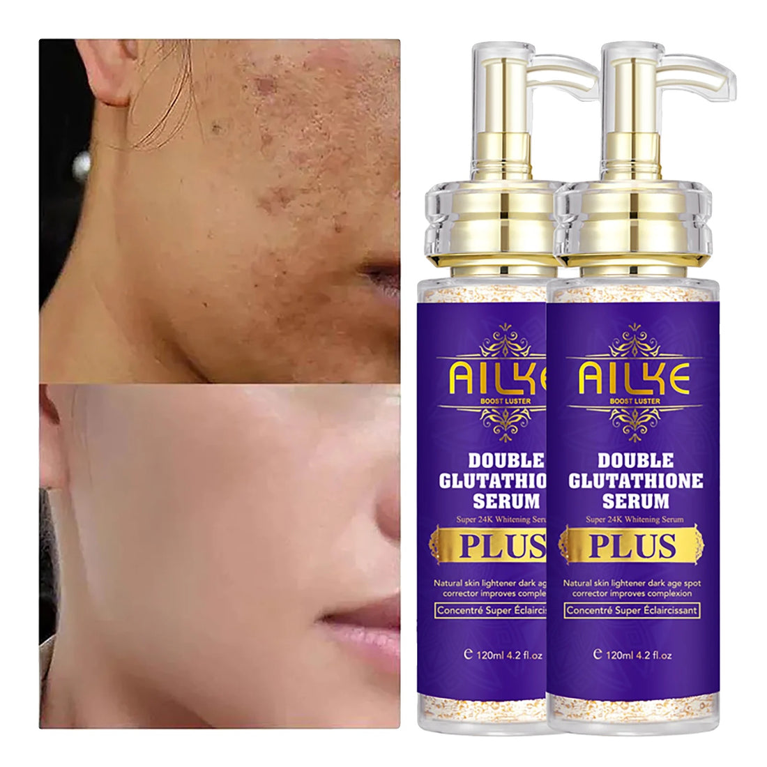 Verhelderend Gezichts- und Lichaamsserum, Verlichtend Gezichtsserum, Unterstützung für Privé Aangepast Logo